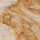 Granite
